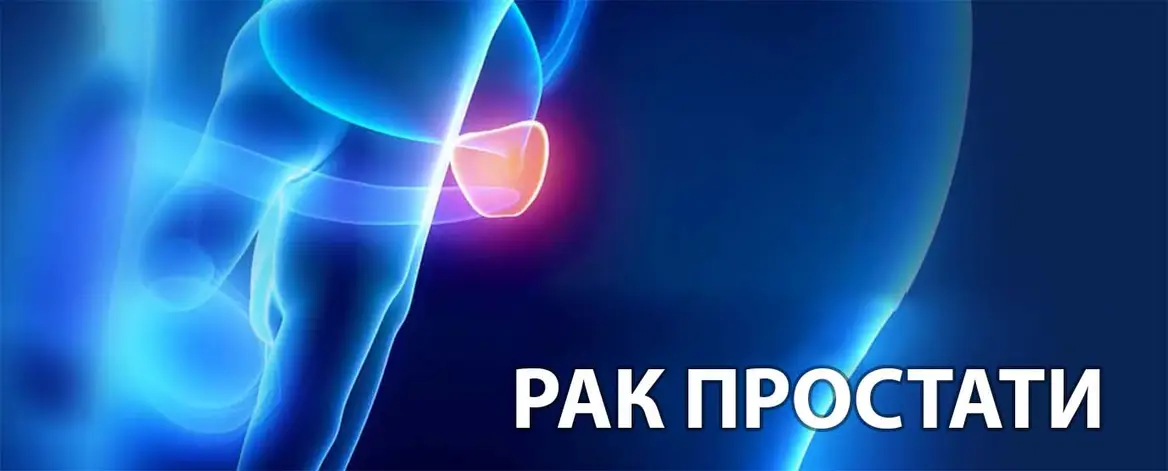 Рак передміхурової залози