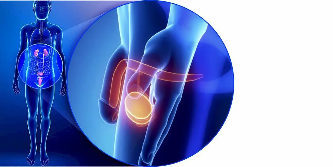 Варікоцеле