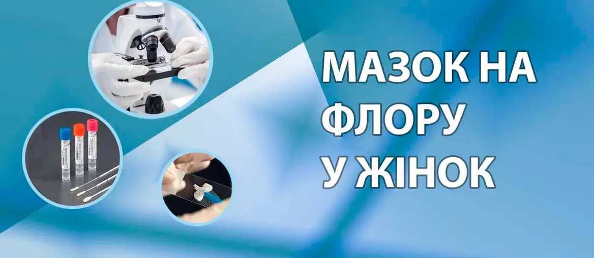 Мазок на флору у жінок