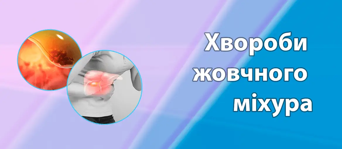 Хвороби жовчного міхура