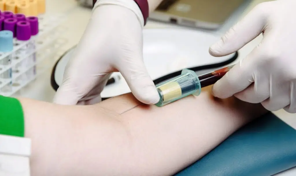 Лабораторні дослідження – перший етап у пошуку системних причин «кому в горлі».
